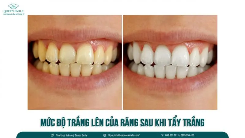 Top 10 Phòng khám nha khoa uy tín nhất quận Hai Bà Trưng, Hà Nội