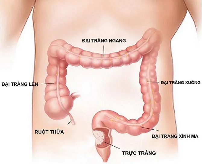 Top 5 Bác sĩ nội soi đại tràng giỏi nhất tại Hà Nội