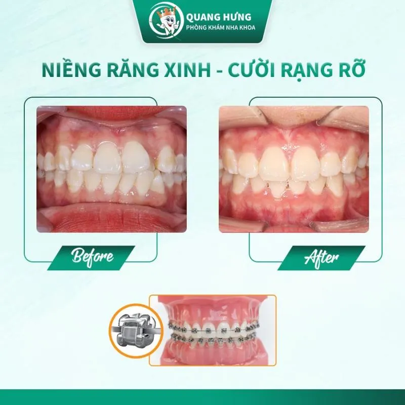 Top 5 Nha khoa tốt nhất huyện Đan Phượng, Hà Nội