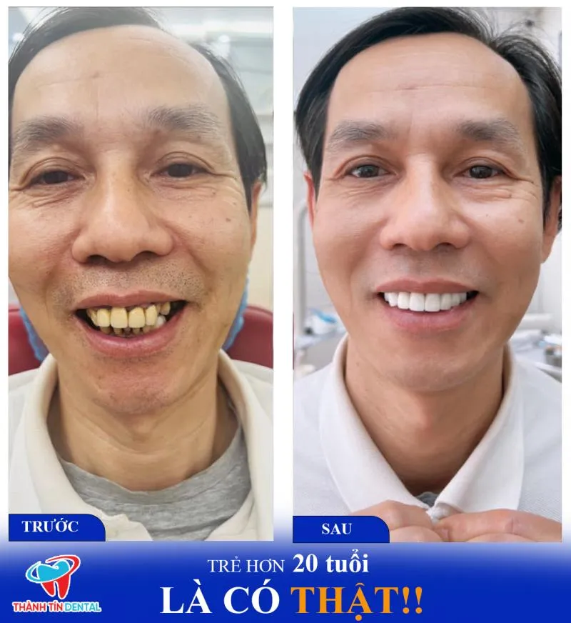 Top 6 Phòng khám nha khoa uy tín nhất quận Bắc Từ Liêm, Hà Nội