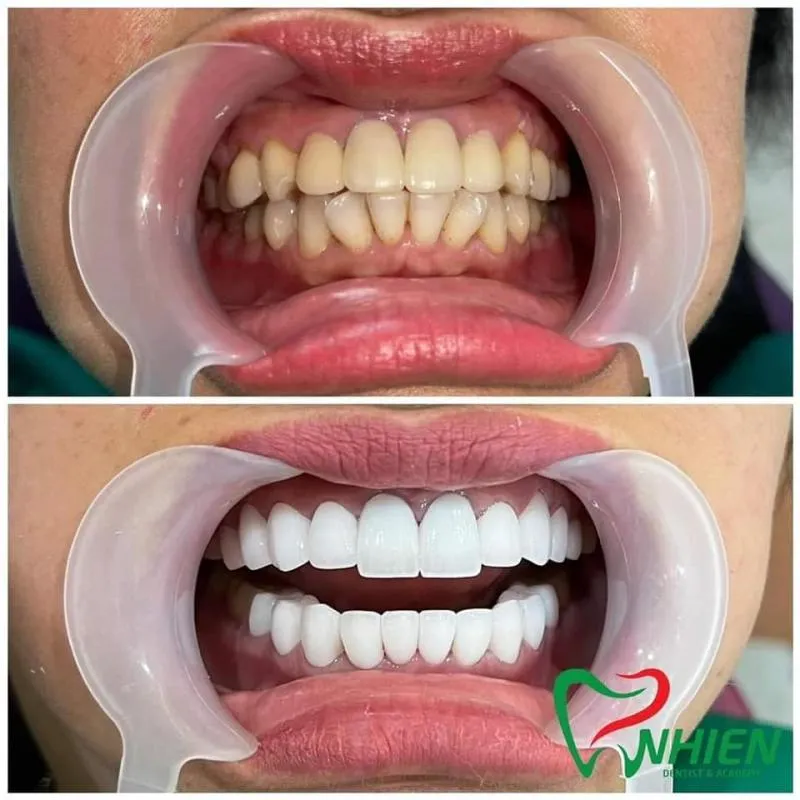 Top 6 Phòng khám nha khoa uy tín nhất quận Bắc Từ Liêm, Hà Nội