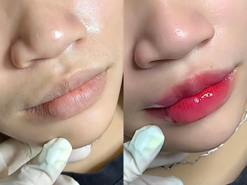 Top 6 Spa làm đẹp uy tín và chất lượng nhất huyện Đông Anh, Hà Nội