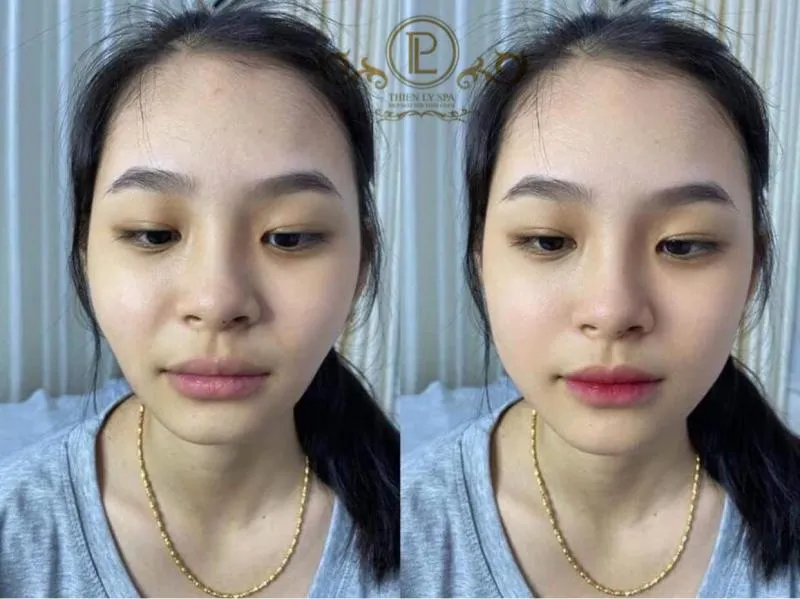 Top 6 Spa làm đẹp uy tín và chất lượng nhất huyện Đông Anh, Hà Nội