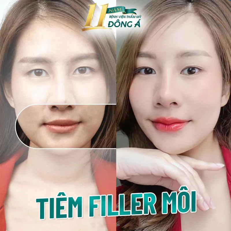 Top 7 Địa chỉ tạo môi trái tim đẹp và chất lượng nhất Hà Nội
