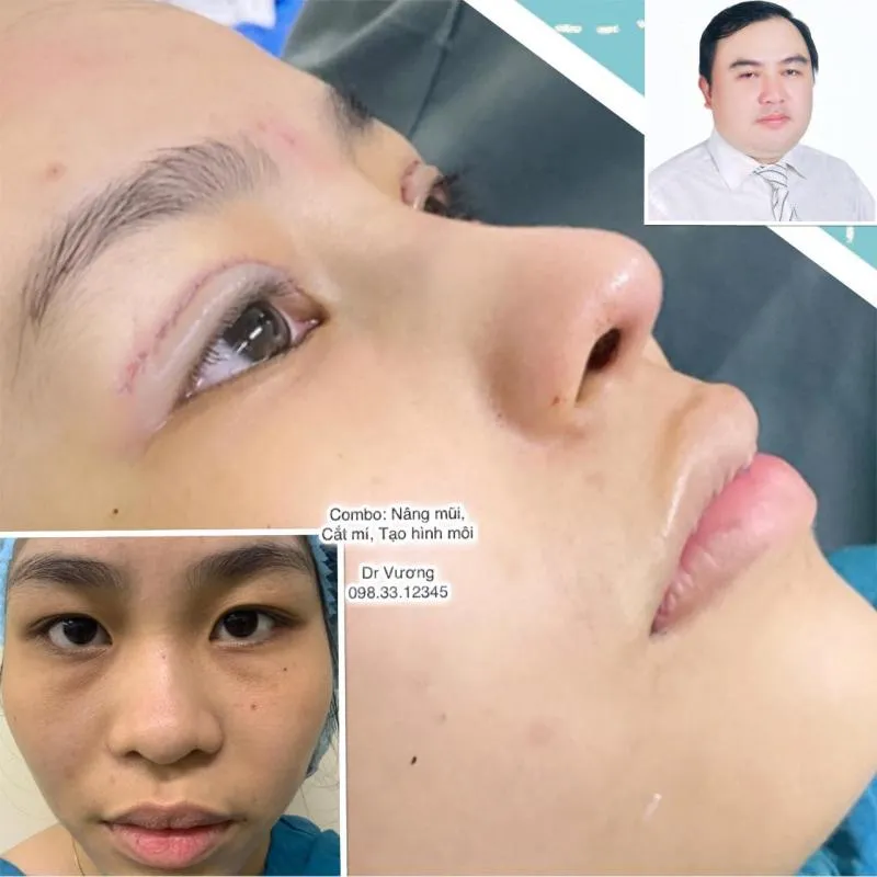 Top 7 Địa chỉ tạo môi trái tim đẹp và chất lượng nhất Hà Nội