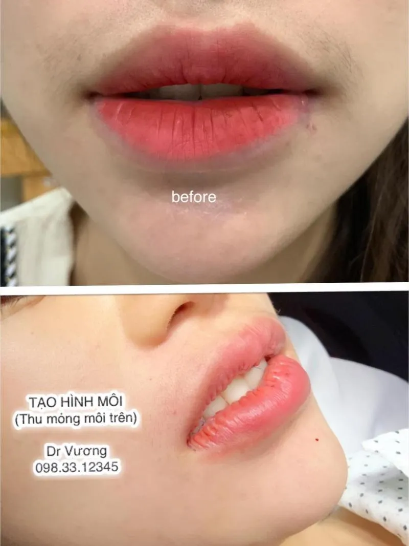 Top 7 Địa chỉ tạo môi trái tim đẹp và chất lượng nhất Hà Nội