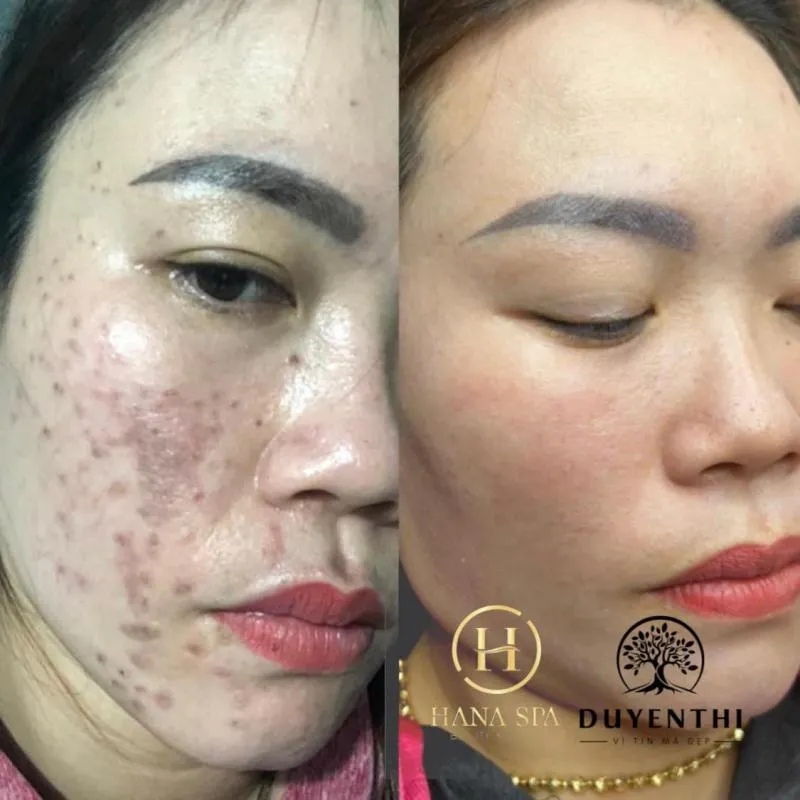Top 9 Spa làm đẹp uy tín nhất huyện Thạch Thất, Hà Nội