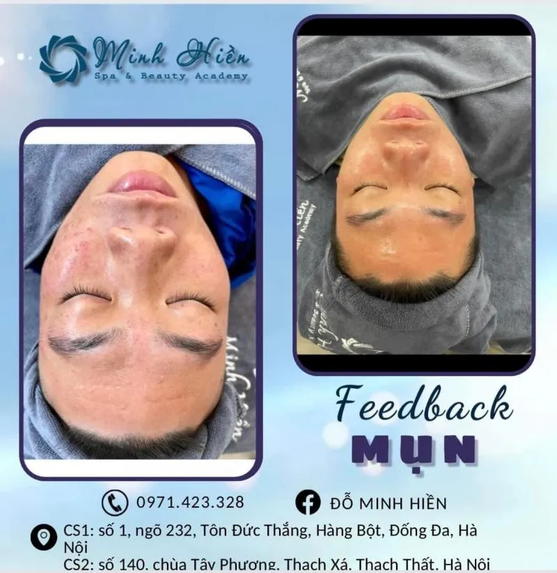 Top 9 Spa làm đẹp uy tín nhất huyện Thạch Thất, Hà Nội