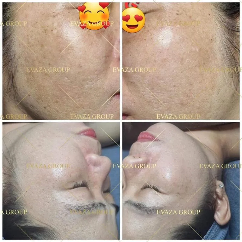 Top 9 Spa làm đẹp uy tín nhất huyện Thạch Thất, Hà Nội