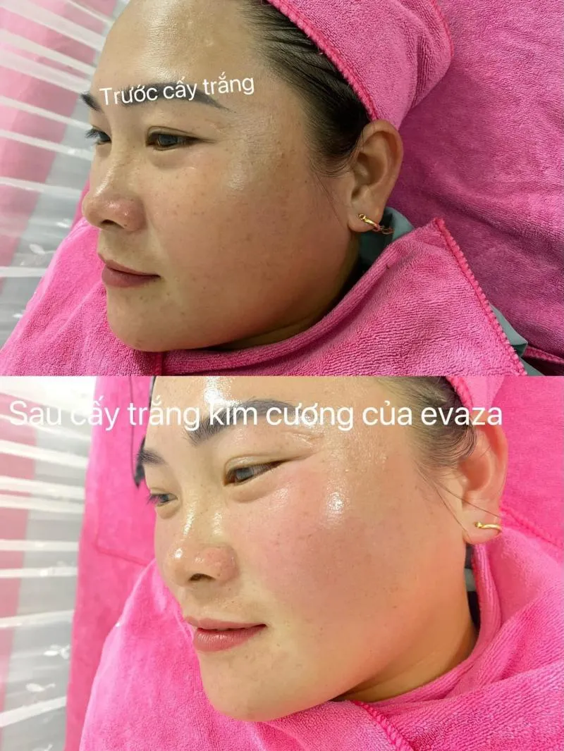 Top 9 Spa làm đẹp uy tín nhất huyện Thạch Thất, Hà Nội