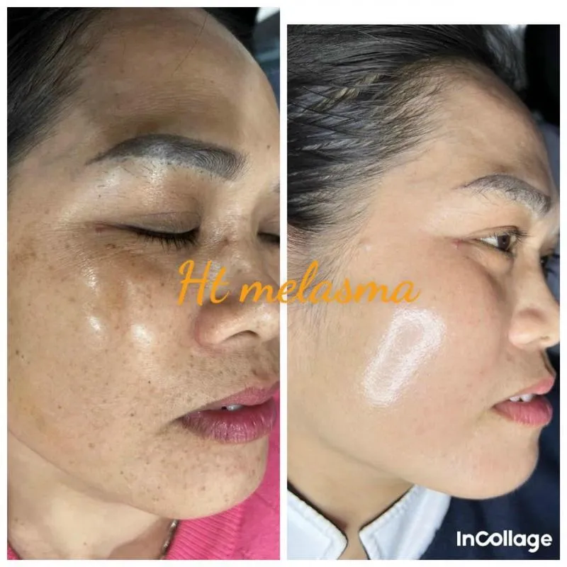 Top 9 Spa làm đẹp uy tín nhất huyện Thạch Thất, Hà Nội