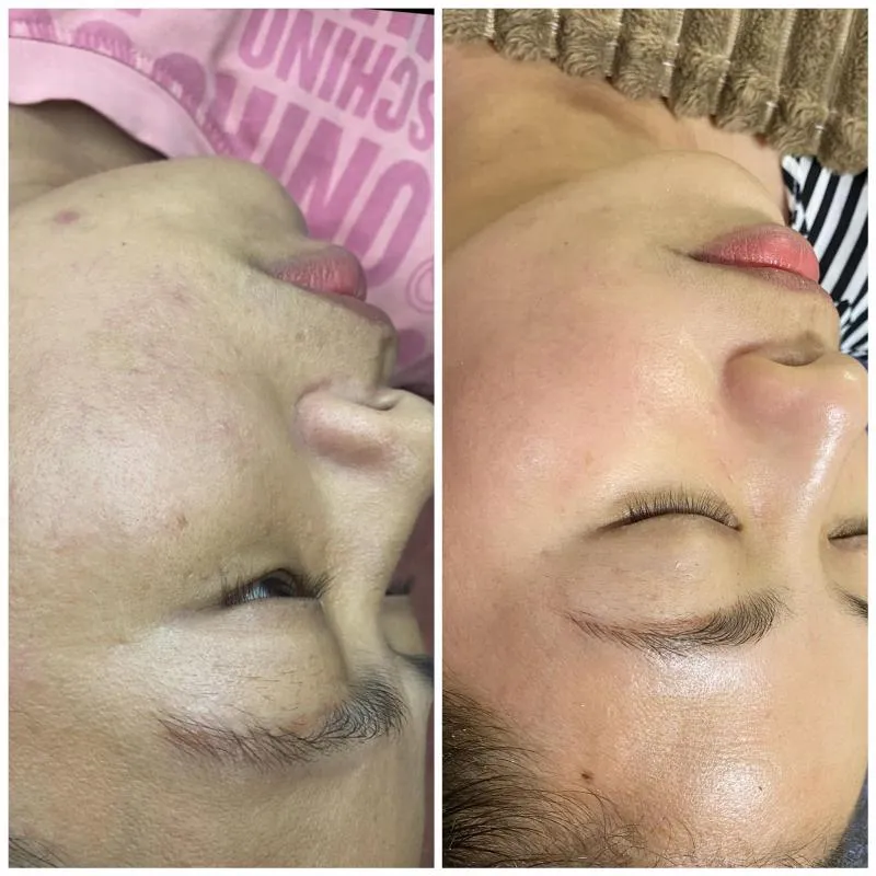 Top 9 Spa làm đẹp uy tín nhất huyện Thạch Thất, Hà Nội