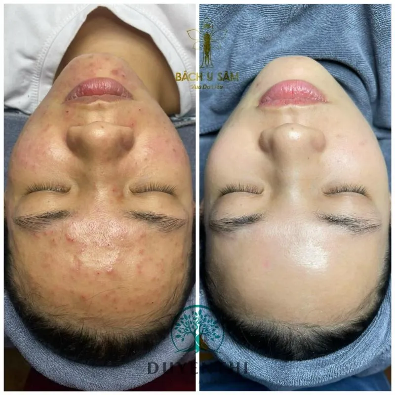 Top 9 Spa làm đẹp uy tín nhất huyện Thạch Thất, Hà Nội